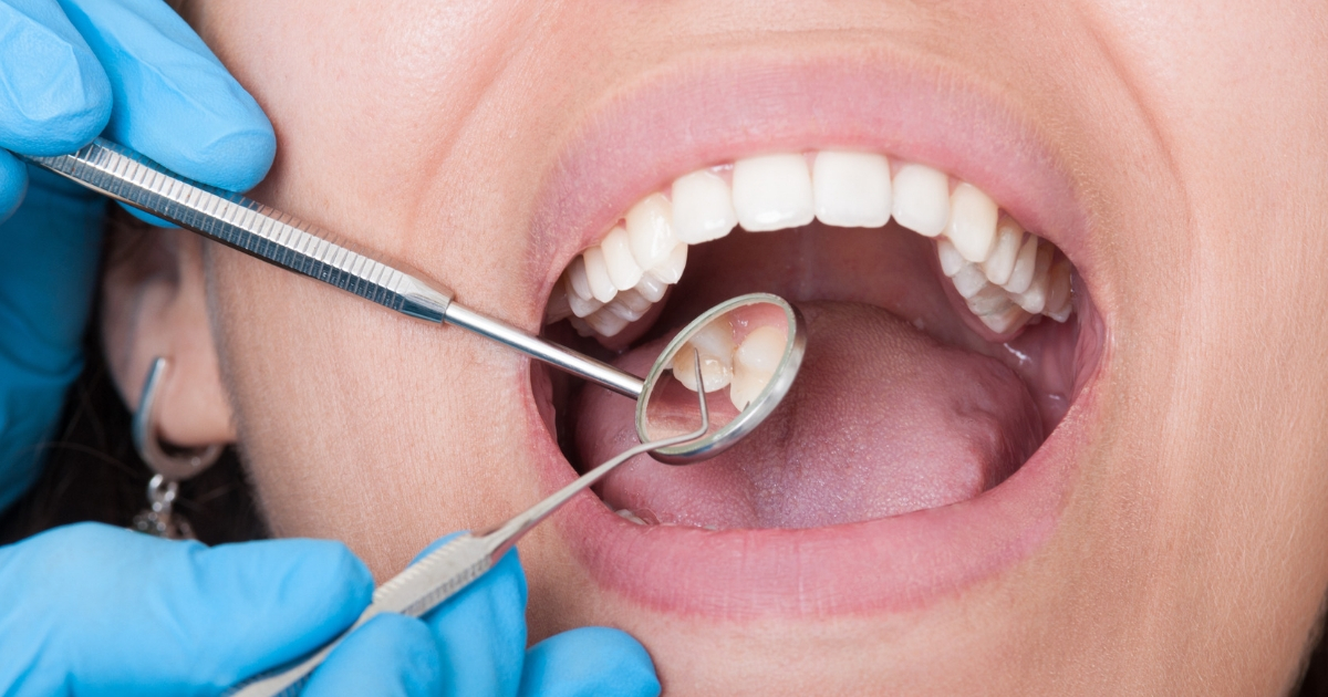 Dental Health - Sepsis Alliance