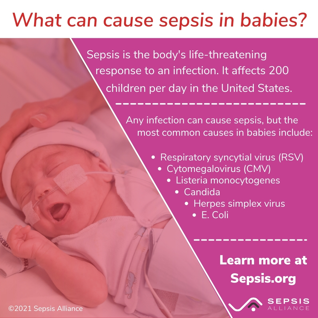 sepsis, pediatric sepsis, children and sepsis